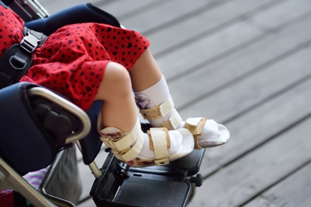 Child with cerebral palsy sitting in a wheel chair